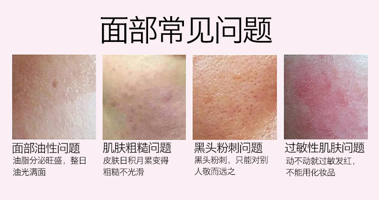 矽膠洗臉刷,矽膠章魚洗臉刷,矽膠潔麵刷,矽膠洗臉神器 矽膠洗臉刷,矽膠章魚洗臉刷,矽膠潔麵刷,矽膠洗臉神器