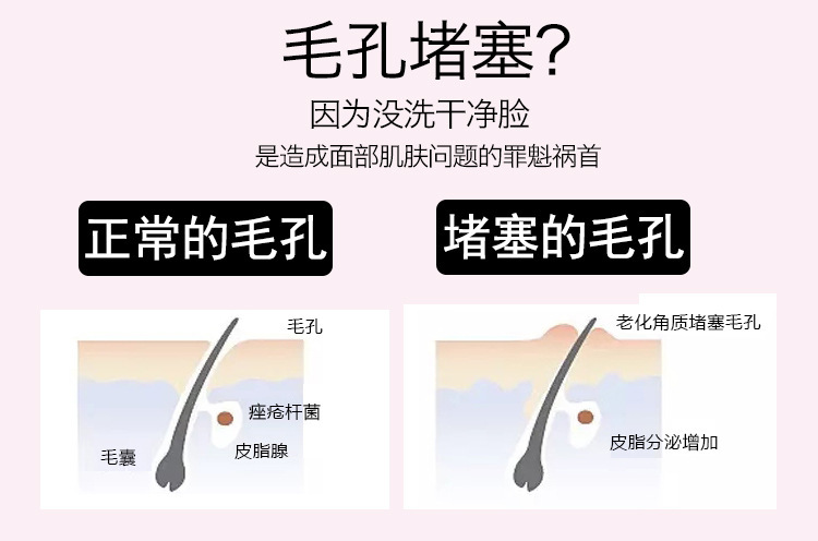 矽膠洗臉刷,矽膠章魚洗臉刷,矽膠潔麵刷,矽膠洗臉神器 矽膠洗臉刷,矽膠章魚洗臉刷,矽膠潔麵刷,矽膠洗臉神器